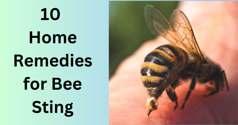 10 Home Remedies for Bee Sting » HaimiWorld