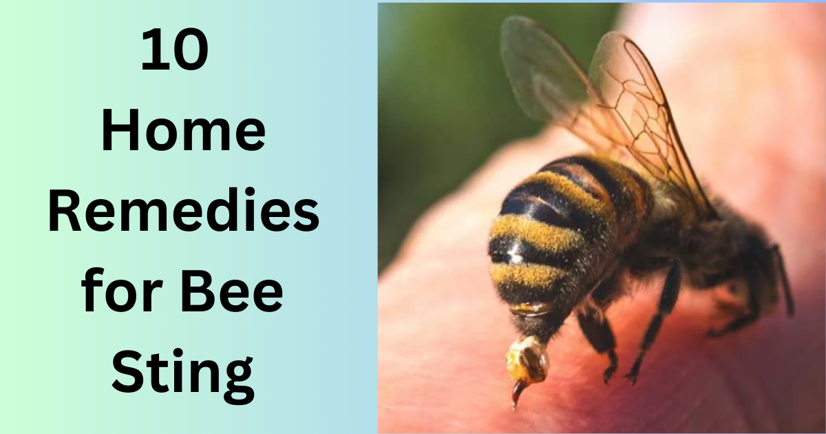 10 Home Remedies for Bee Sting